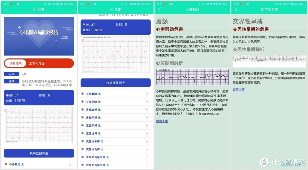 比小米手表更实用，能测血压、心电图的Dido E10智能手表评测